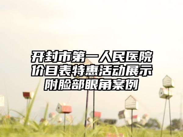 开封市第一人民医院价目表特惠活动展示附脸部眼角案例