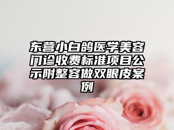 东营小白鸽医学美容门诊收费标准项目公示附整容做双眼皮案例