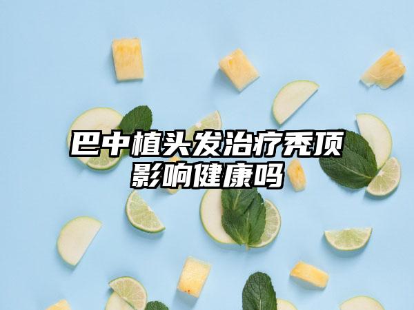 巴中植头发治疗秃顶影响健康吗