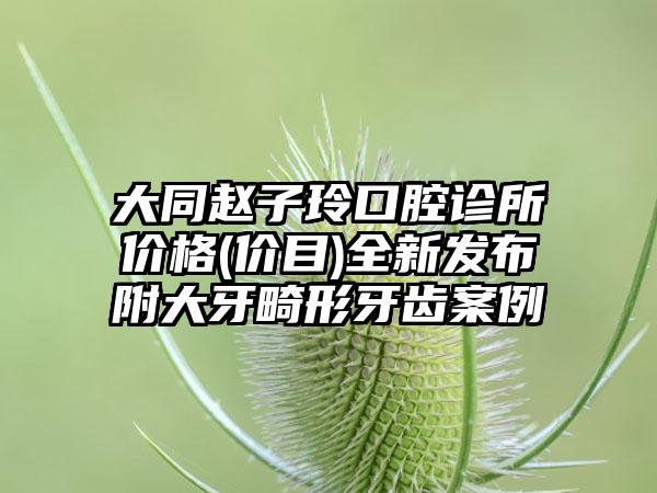 大同赵子玲口腔诊所价格(价目)全新发布附大牙畸形牙齿案例