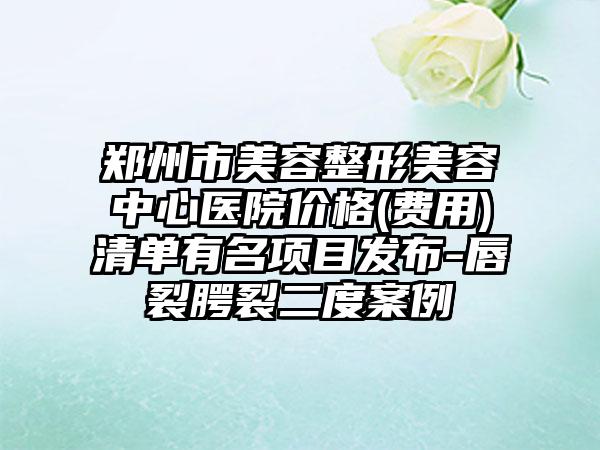 郑州市美容整形美容中心医院价格(费用)清单有名项目发布-唇裂腭裂二度案例